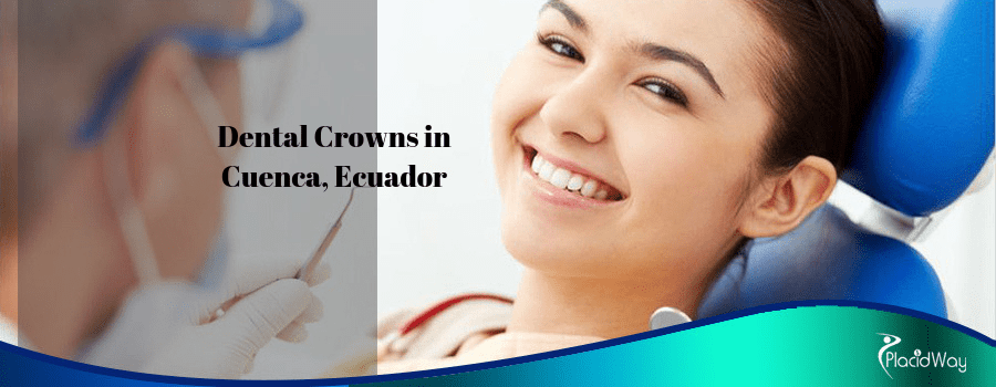 Understanding the Benefits of Dental Crowns in Cuenca
